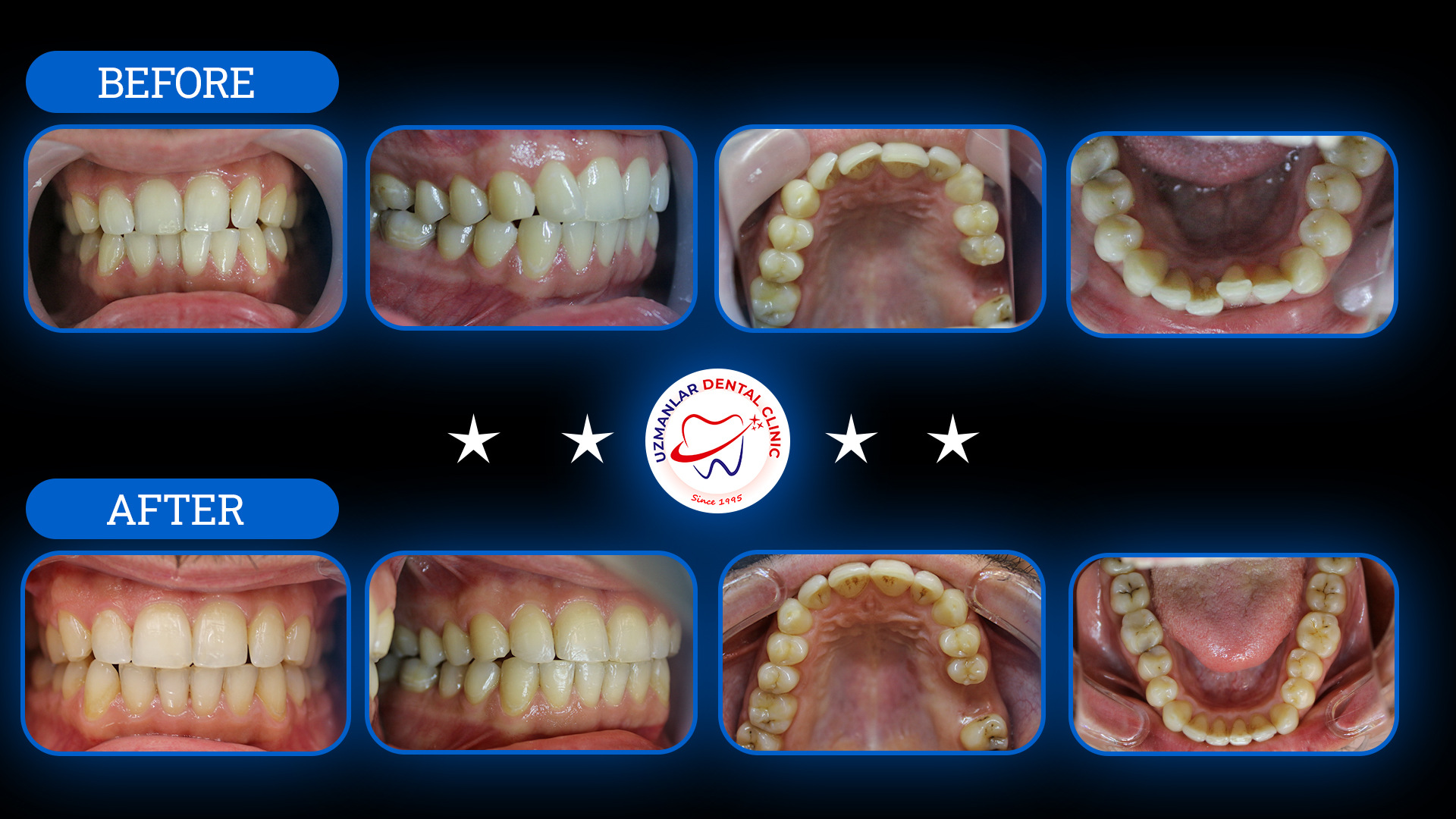 Tedavi Öncesi ve Sonrası 3
